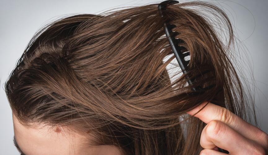 DU_ARGEAL_SILO_FETTIGE HAARE_GENERAL_L2_HEADER